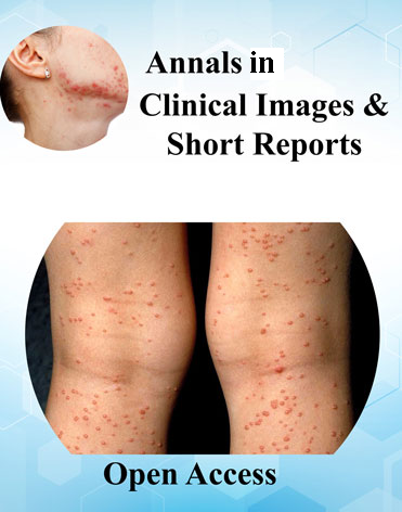 Annals of Short Reports and Clinical Images